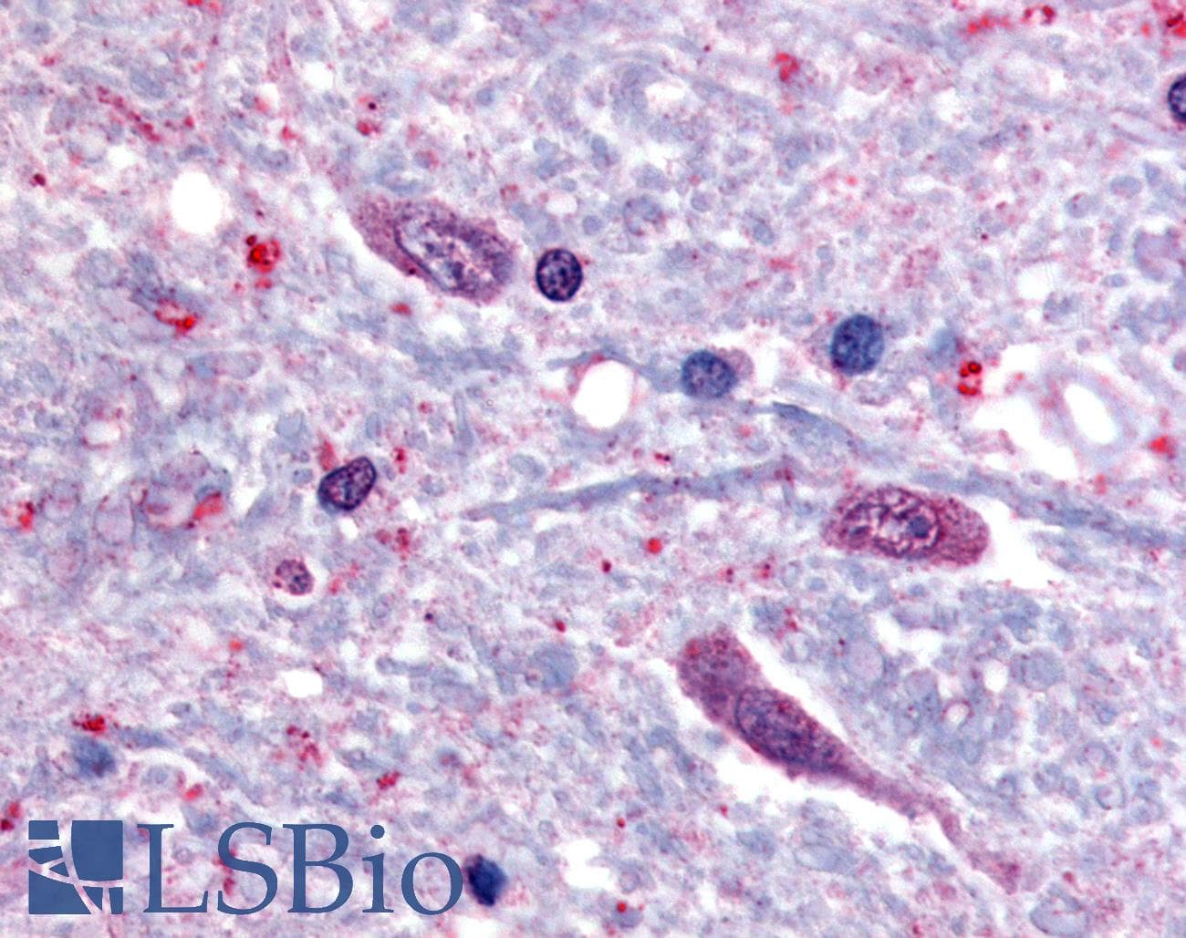 IHC-plus™ SLC5A3 Antibody (C-Terminus)