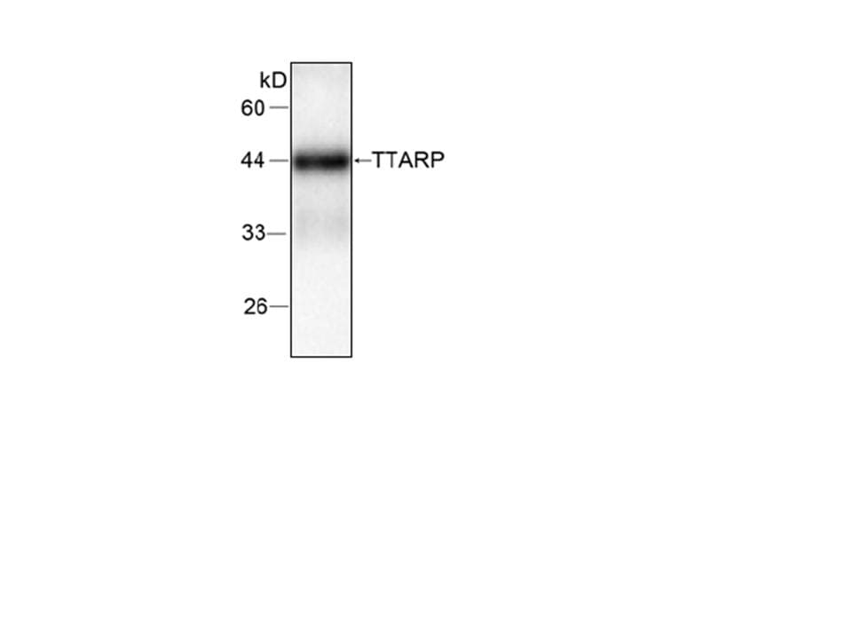 Monoclonal Mouse anti-Human TDP2 / TTRAP Antibody (WB)