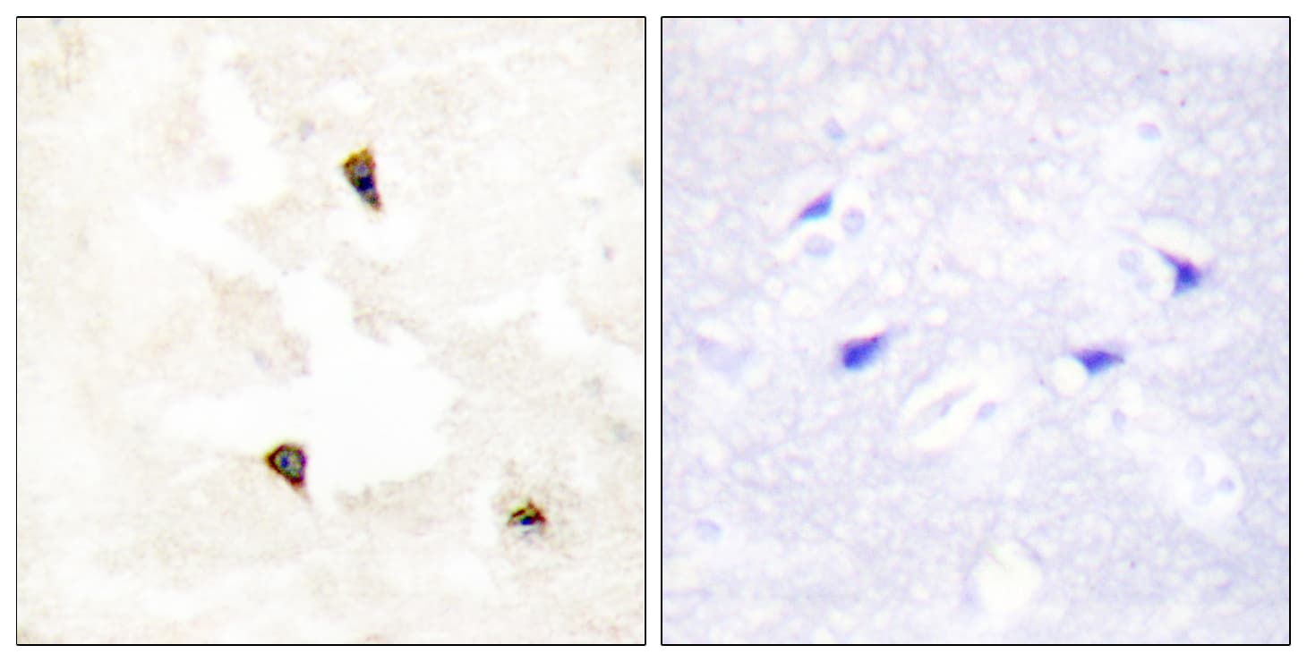TP53I11 / PIG11 Antibody (aa71-120)