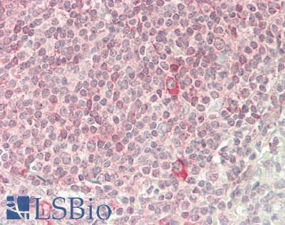 KLRD1 / CD94 Antibody (aa61-110)