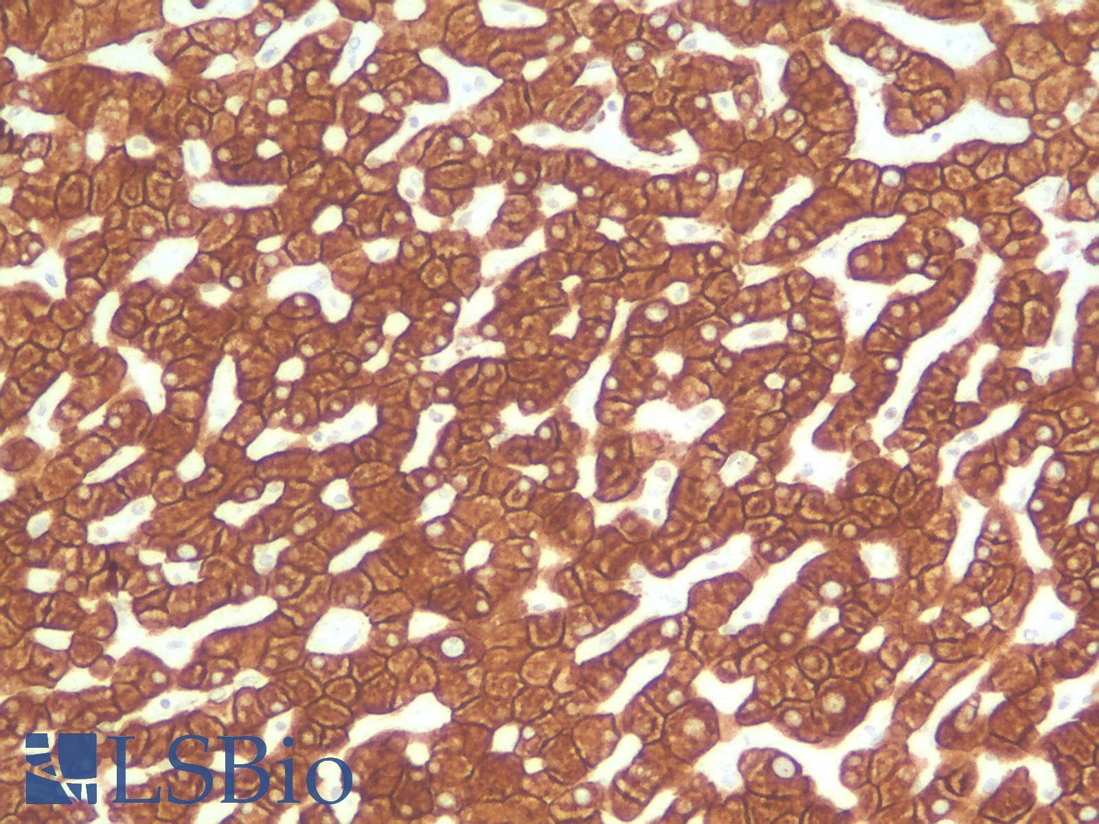 PathPlus™ Monoclonal Mouse anti-Human KRT18 / CK18 / Cytokeratin 18 Antibody (Concentrated, IHC)