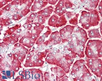 PathPlus™ CALR / Calreticulin Antibody (aa301-350)