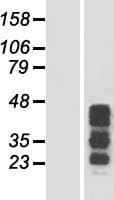 CCDC17 Protein (Over-Expression Lysate Myc-DDK (Flag))