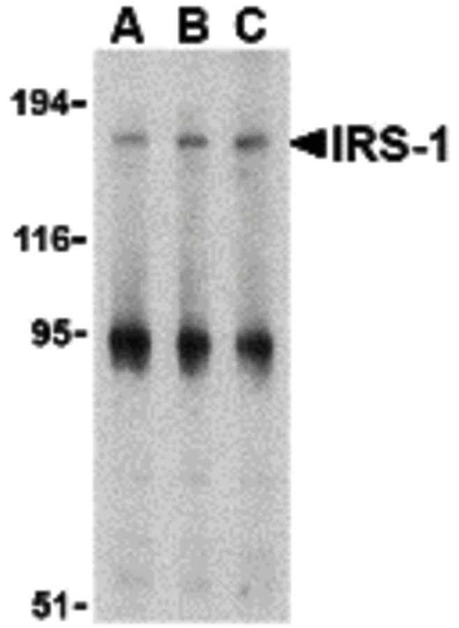 IHC-plus™ Polyclonal Rabbit anti-Human IRS1 Antibody (IHC, IF, WB)