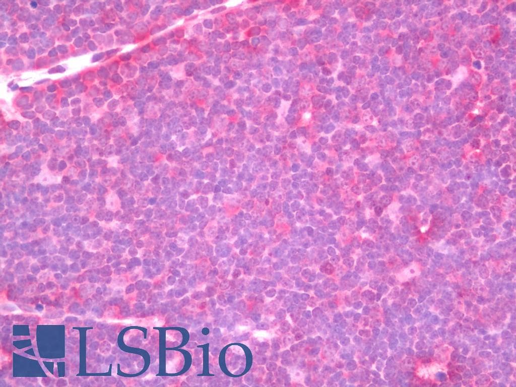 IHC-plus™ PIAS2 / PIASX Antibody (aa10-59)