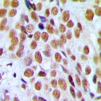 Polyclonal Rabbit anti-Human PR / Progesterone Receptor Antibody (Internal, IHC, IF, WB)