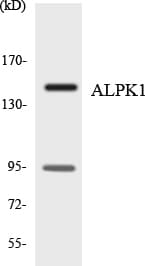ALPK1 Antibody (aa24-73)