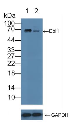 DBH/Dopamine Beta Hydroxylase Antibody (aa335-571)