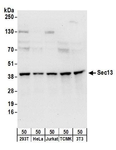 Polyclonal Rabbit anti-Human SRP68 Antibody (aa1-50, WB)