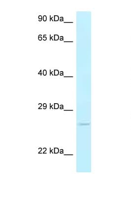 AK3 / Adenylate Kinase 3 Antibody (aa125-174)