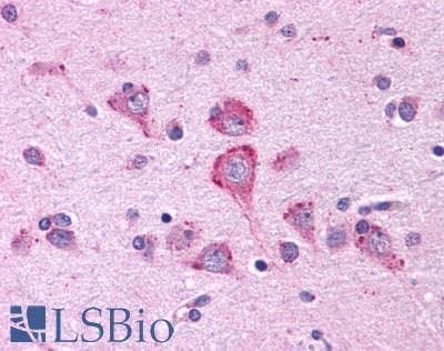PathPlus™ GPR80 / GPR99 / OXGR1 Antibody (N-Terminus)