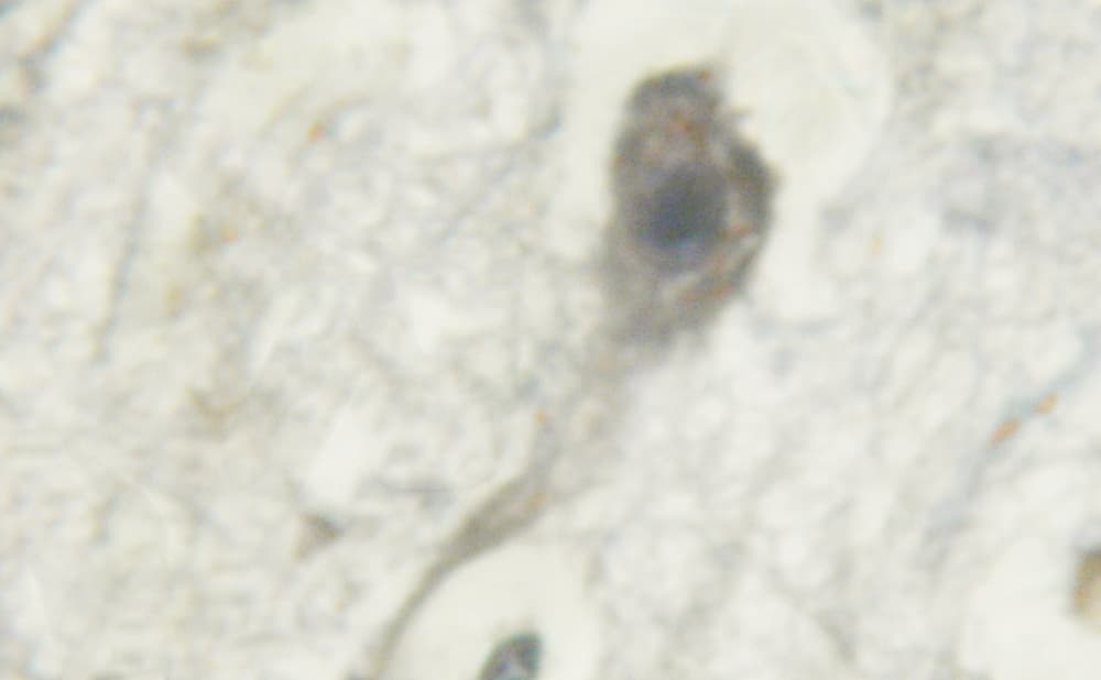 PRKD1 / PKC Mu Antibody (phospho-Tyr463)