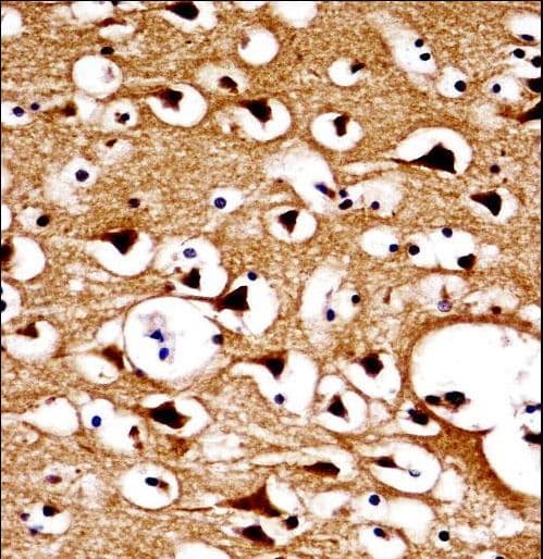 Polyclonal Rabbit anti-Human NUMBLIKE / NUMBL Antibody (aa572-600, IHC, WB)