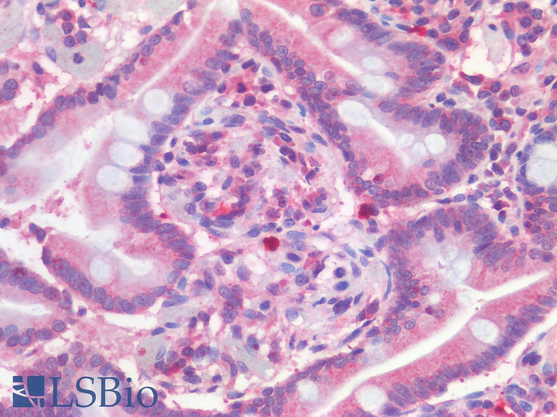 IHC-plus™ FPR1 / FPR Antibody (aa155-204)
