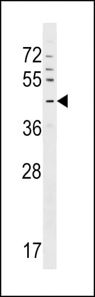 GPR63 Antibody (aa381-410)