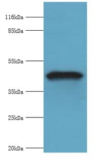GIF / Intrinsic Factor Antibody (aa19-417)