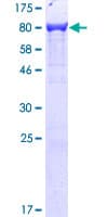 Human PLS3 / T Plastin Protein (Recombinant GST)