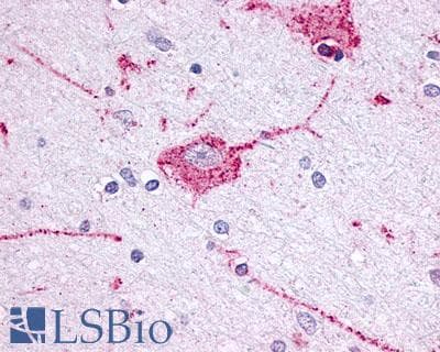 PathPlus™ OPRM1 / Mu Opioid Receptor Antibody (Extracellular Domain)