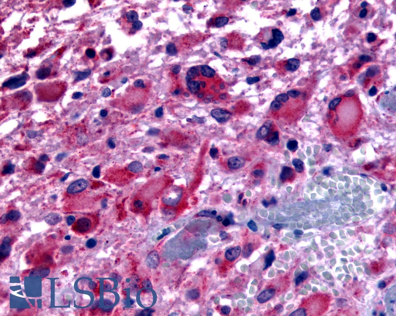 PathPlus™ CHRM2 / M2 Antibody (Cytoplasmic Domain)