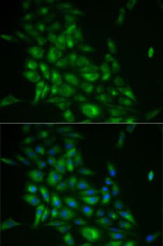 STMN1 / Stathmin / LAG Antibody