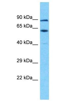 TSGA10IP Antibody (aa52-101)