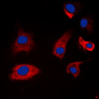 SYN1 / Synapsin 1 Antibody (phospho-Ser9)