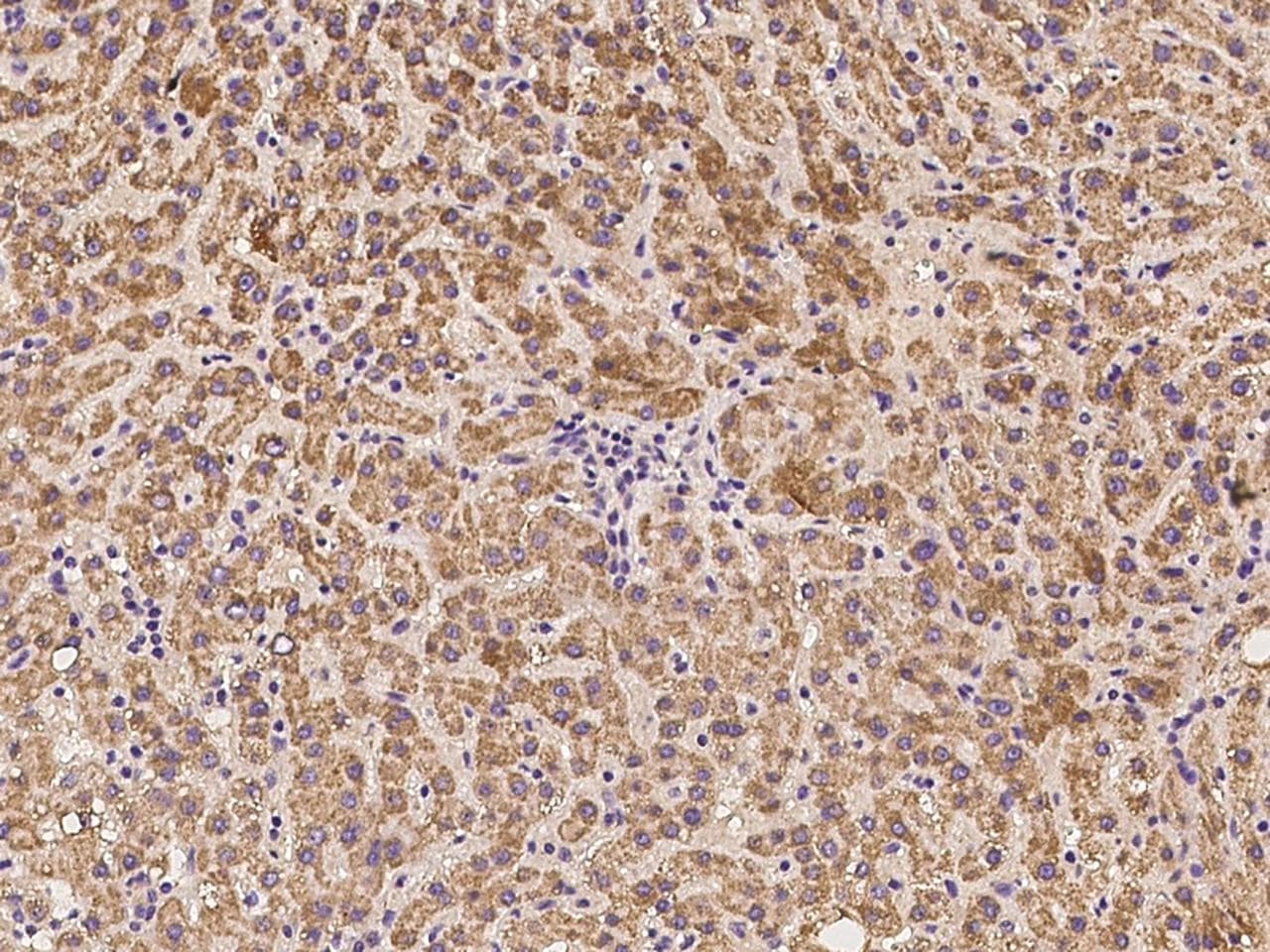 Polyclonal Rabbit anti-Human BABAM1 / HSPC142 Antibody (IHC)