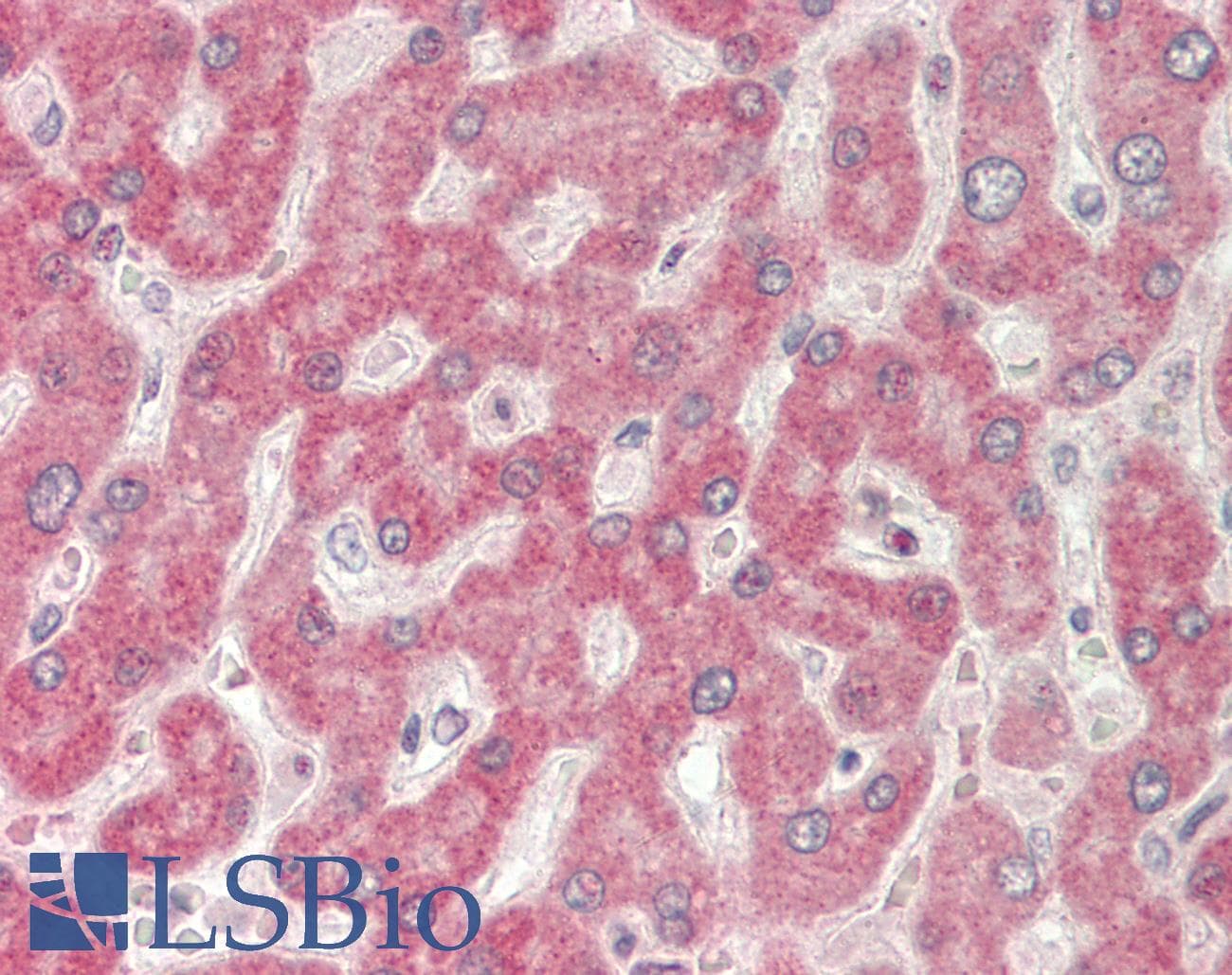 IHC-plus™ GLYATL1 Antibody (aa73-302)