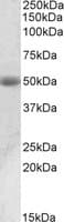 IHC-plus™ ACPP / PAP Antibody (aa269-282)