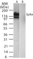 Polyclonal Rabbit anti-Coronavirus SARS-CoV Spike Glycoprotein Antibody (aa441-453, WB)