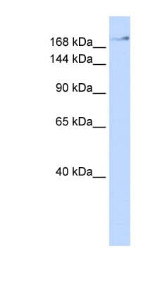 ZMYM4 / ZNF262 Antibody (aa144-193)