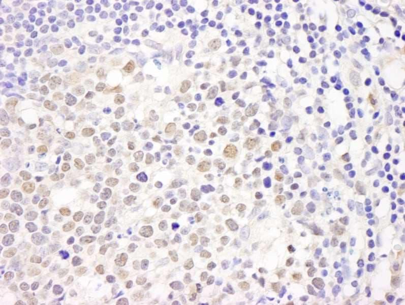 Polyclonal Rabbit anti-Human CHAF1A / CAF1 Antibody (aa500-550, IHC, WB)