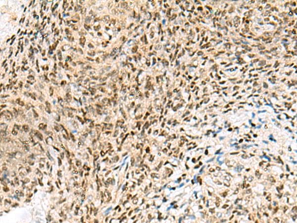 UBLCP1 Antibody