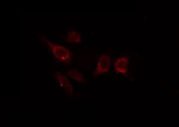 CDK1 / CDC2 Antibody (phospho-Tyr15)