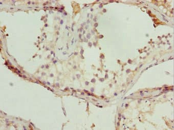 TBPL1 / TRF2 Antibody