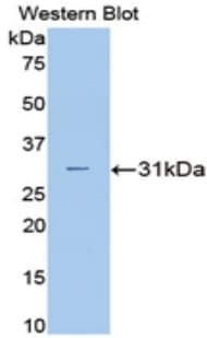 CA2 / Carbonic Anhydrase II Antibody (aa1-260, APC)