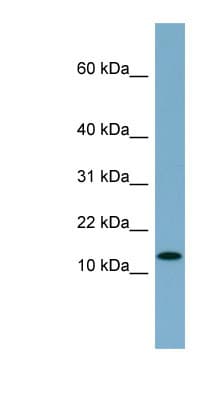 Polyclonal Rabbit anti-Human RPS27L Antibody (N-Terminus, WB)