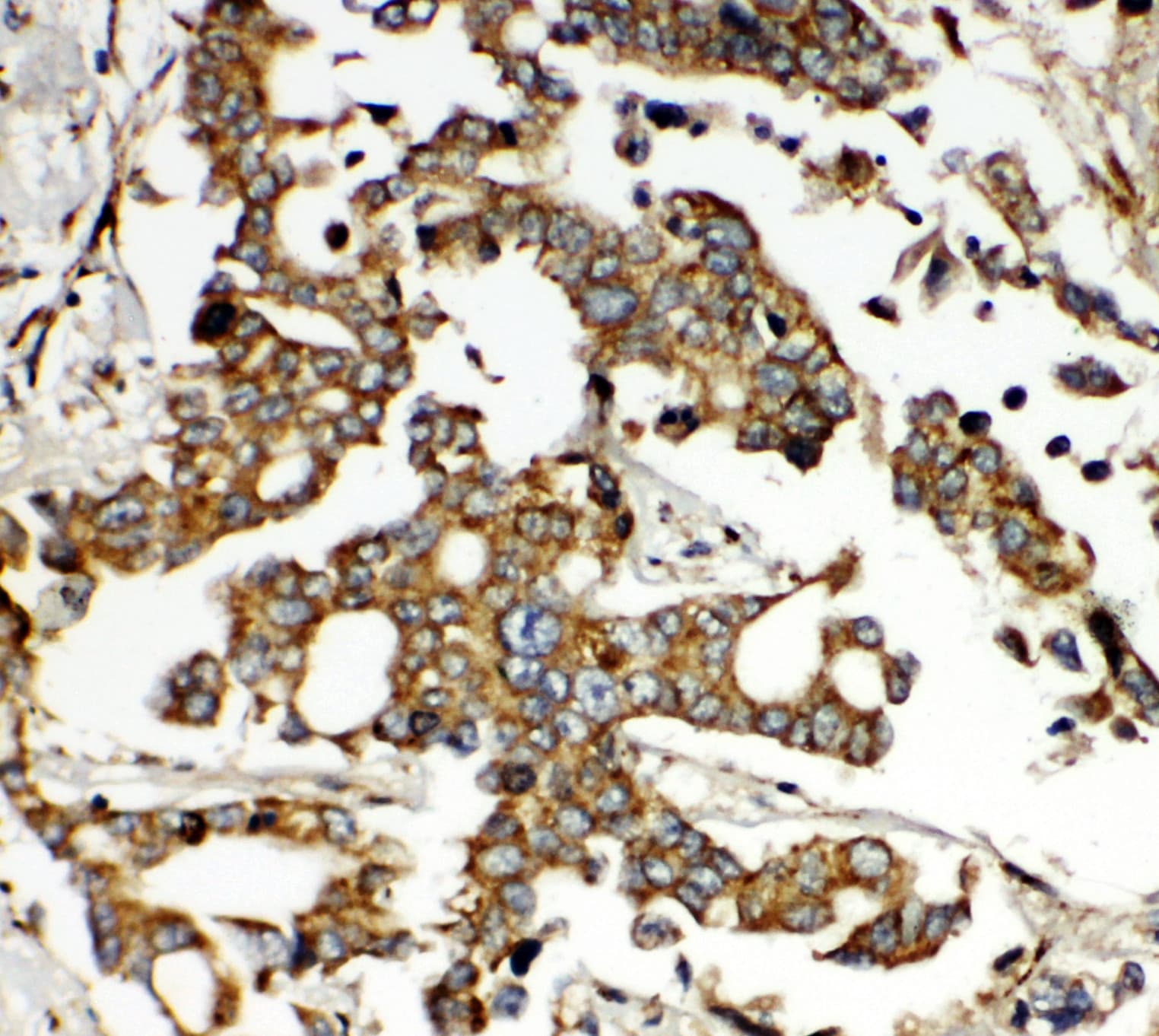 Polyclonal Rabbit anti-Human ONECUT1 / HNF6 Antibody (aa187-203, IHC, WB)