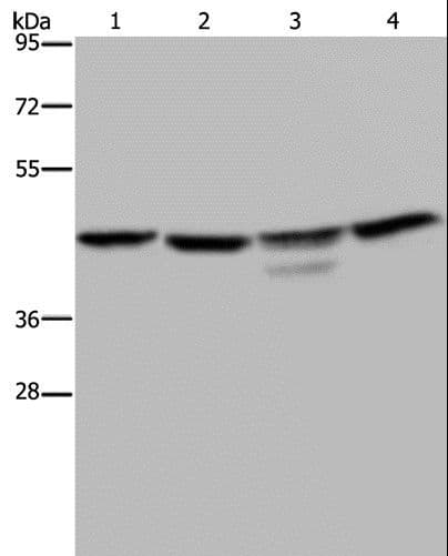 CSNK2A1 Antibody