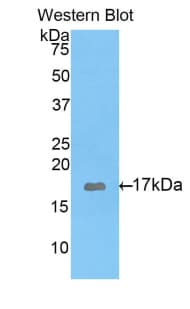 GAD1 / GAD67 Antibody (aa1-97)