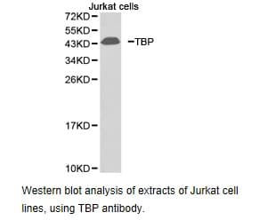 TBP / GTF2D Antibody
