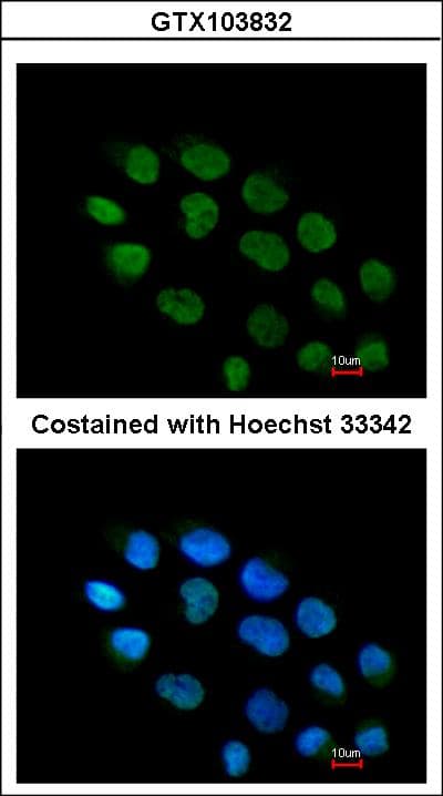 ZNF7 Antibody (aa77-570)
