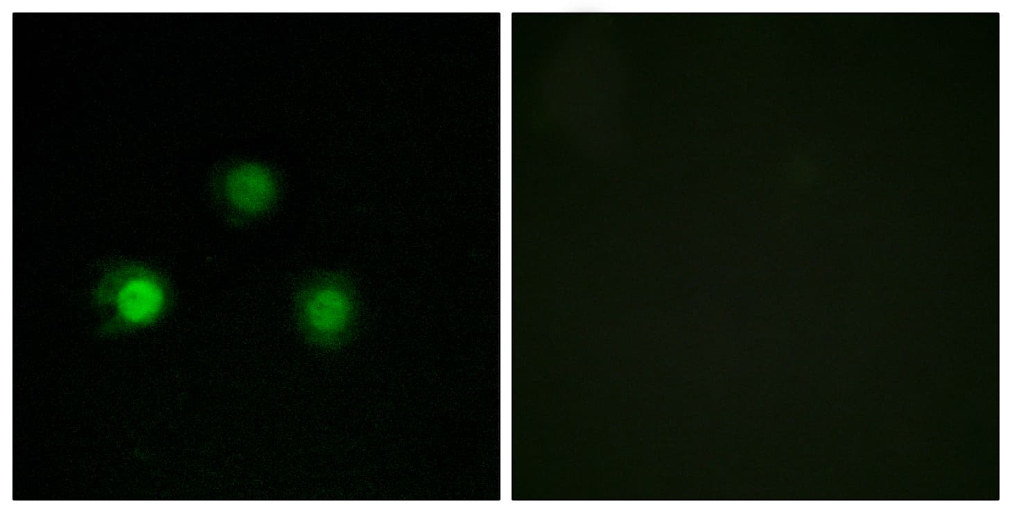 Polyclonal Rabbit anti-Human MSH2 Antibody (aa541-590, IHC, IF)