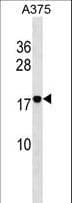 RHOF Antibody (aa178-206)