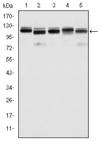 IHC-plus™ Monoclonal Mouse anti-Human BMPR2 Antibody (clone 3F6, IHC, IF, WB)