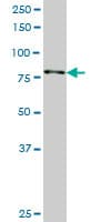 RPS6KA3 / RSK2 Antibody (clone 2G10)