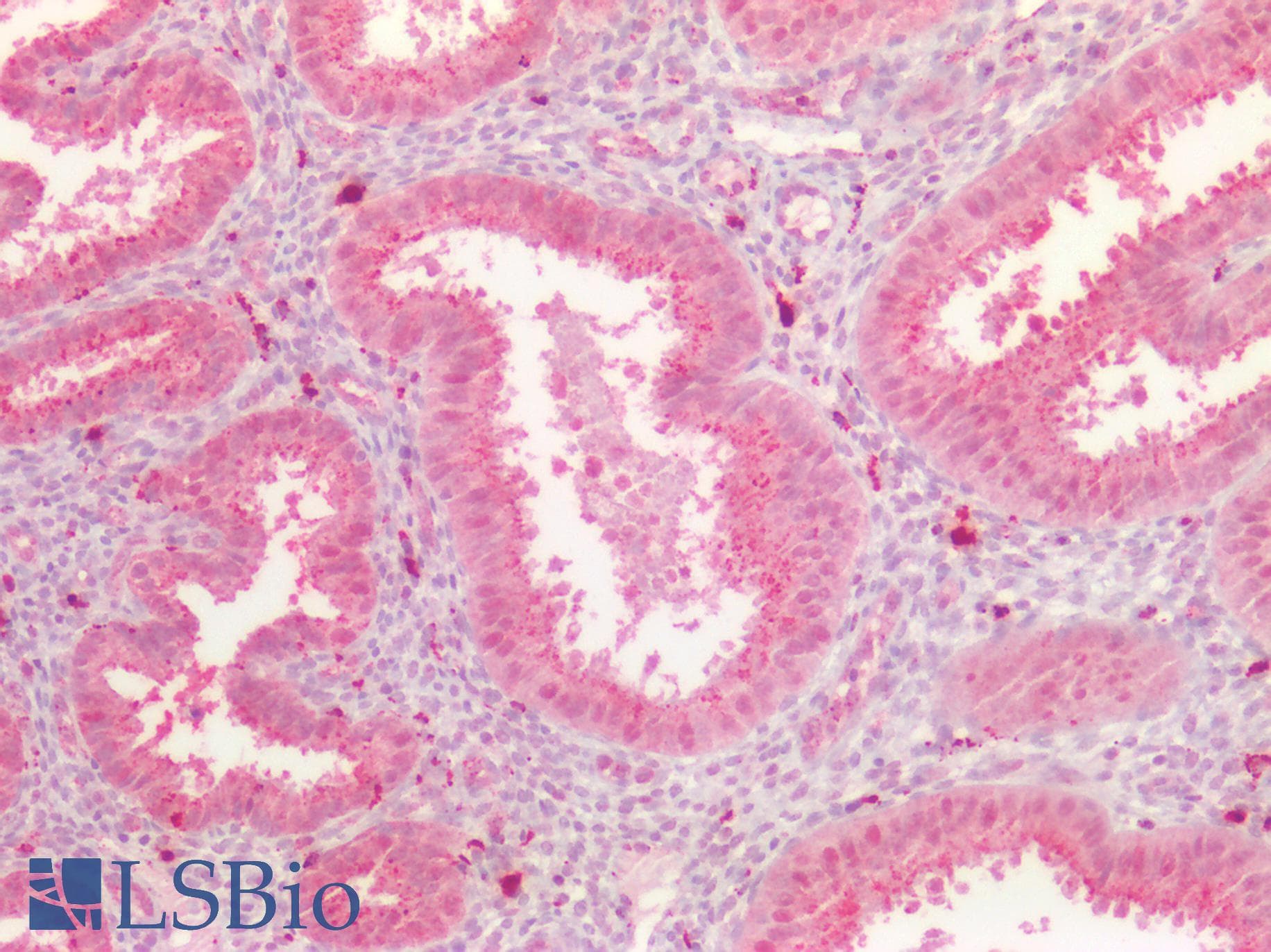 PathPlus™ Polyclonal Rabbit anti-Human AXIN2 / Axin 2 Antibody (IHC, IF, WB)