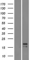 Human LHB / Luteinizing Hormone Protein (Over-Expression Lysate Myc-DDK (Flag))