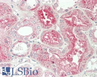 Polyclonal Rabbit anti-Human GPT / Alanine Transaminase Antibody (aa147-263, IHC, WB)