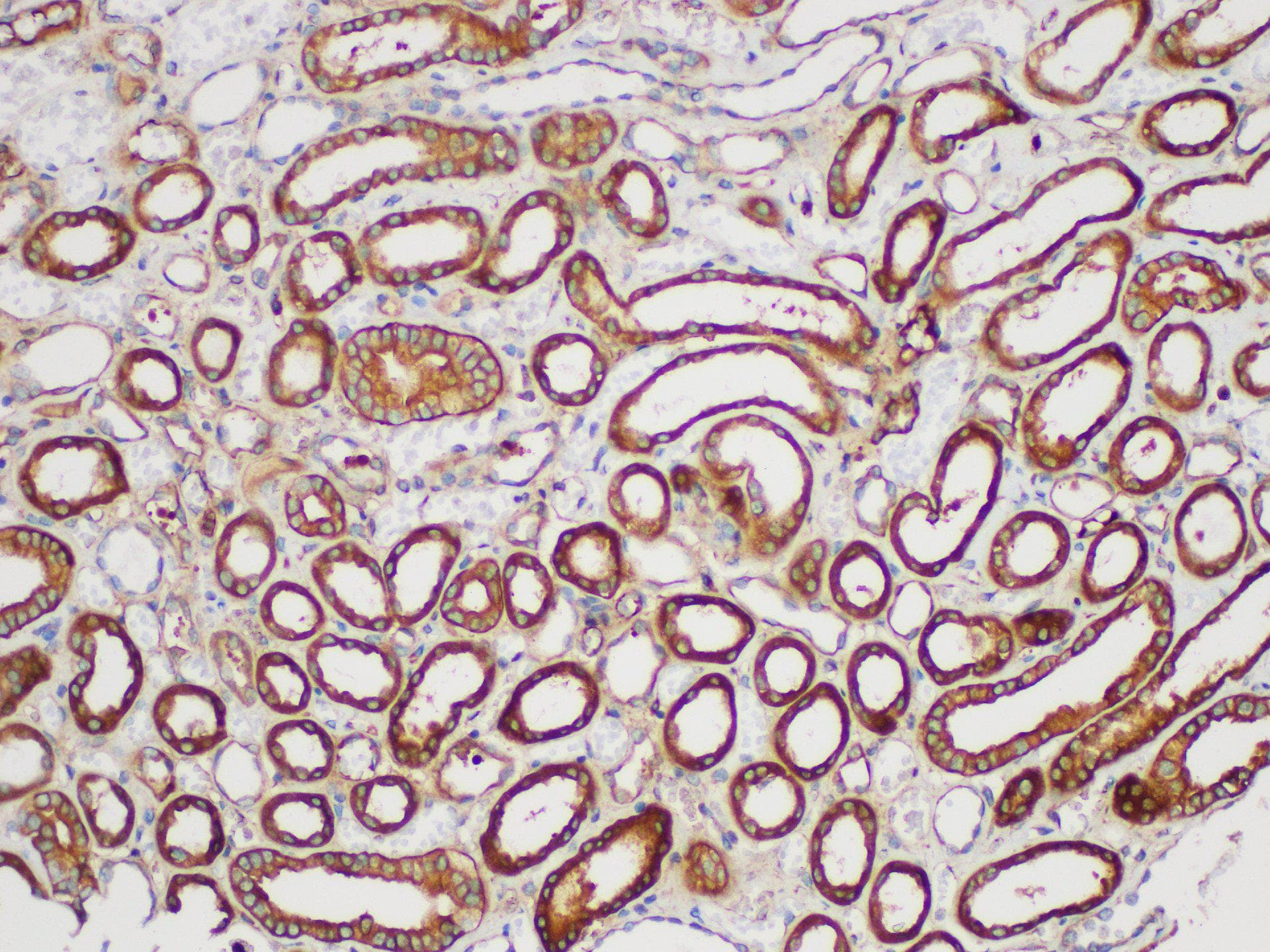 SERPINB2 / PAI-2 Antibody